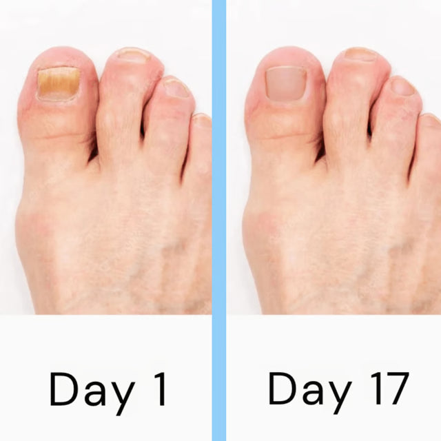 Upgrade Your Nail Care Routine with a Light-Based Nail Care Device