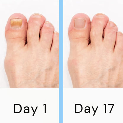 Upgrade Your Nail Care Routine with a Light-Based Nail Care Device