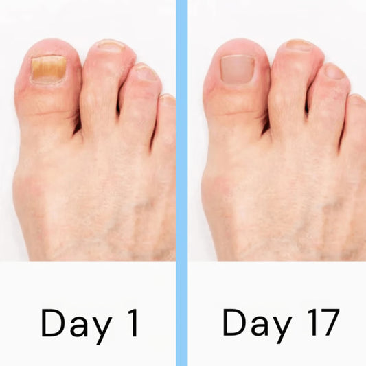 Upgrade Your Nail Care Routine with a Light-Based Nail Care Device